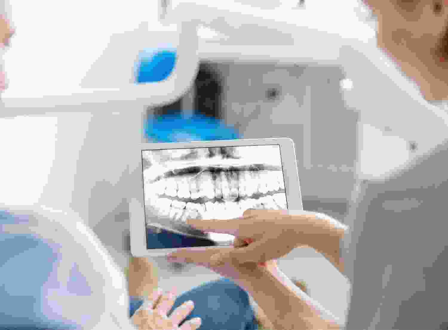 Root Canal Treatment